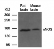 AP09502PU-N - NOS1