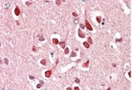 AP09568PU-N - UNC5C