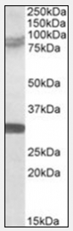 AP09569PU-N - TRIM2 / RNF86