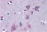 AP09569PU-N - TRIM2 / RNF86