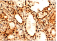 AP09633PU-N - FOXE1 / FKHL15
