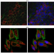 AP10564PU-N - Kinectin