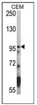 AP11134PU-N - HDAC7