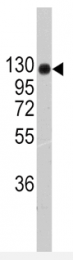 AP11379PU-N - Collagen type II alpha 1 chain