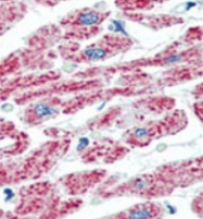 AP11745PU-N - ACO2