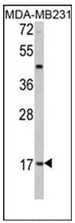 AP13112PU-N - Leptin