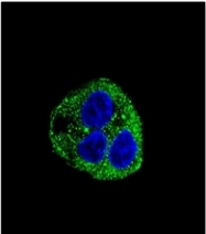 AP13112PU-N - Leptin