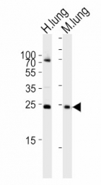 AP13235PU-N - Sclerostin / SOST