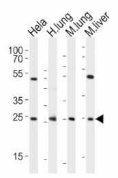 AP13235PU-N - Sclerostin / SOST