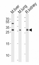 AP13235PU-N - Sclerostin / SOST