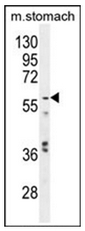 AP13408PU-N - Glypican-3 / GPC3