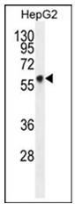 AP13408PU-N - Glypican-3 / GPC3