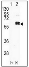 AP13743PU-N - CDKL2
