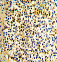 AP14090PU-N - L-xylulose reductase