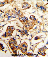AP14584PU-N - Alpha-actinin-4 / ACTN4