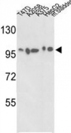 AP14584PU-N - Alpha-actinin-4 / ACTN4