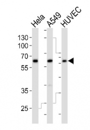 AP14717PU-N - Estrogen-related receptor gamma