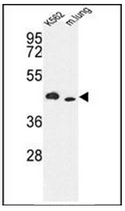 AP15175PU-N - ITPKA / IP3 3-kinase A