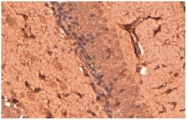 AP15901PU-N - TRPM7