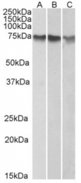 AP15925PU-N - ATF2