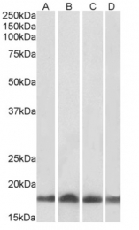 AP16098PU-N - UBE2L3 / UBCH7