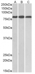 AP16104PU-N - MID2 / RNF60