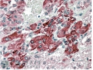 AP16297PU-N - SLC18A2 / VMAT2
