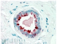 TA303104 - PIP / GCDFP15