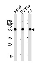 AP17172PU-N - Calreticulin