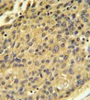 AP17259PU-N - Cathepsin H