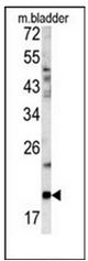 AP17420PU-N - Glucagon