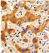AP17420PU-N - Glucagon