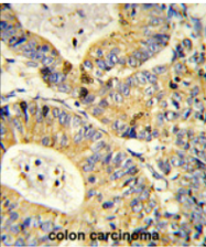 AP17722PU-N - RPS18