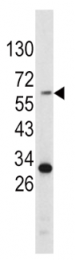 AP17815PU-N - Tyrosinase (TYR)