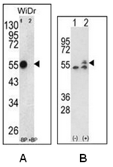 AP17895PU-N - ATP synthase subunit beta