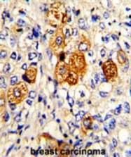 AP17914PU-N - Complement C5