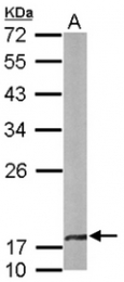 AP19052PU-N - Beta-crystallin A4