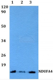 AP20126PU-N - NDUFA4