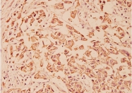 AP20195PU-N - CD324 / Cadherin-1