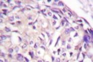 AP20206PU-N - Aurora kinase A