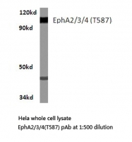 AP20225PU-N - EPHA2 / ECK