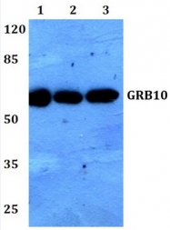 AP20303PU-N - GRB10 / GRBIR