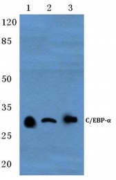 AP20354PU-N - CEBPA