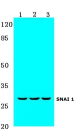 AP20370PU-N - SNAI1