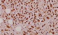 AP20373PU-N - Tumor necrosis factor (TNF-alpha)