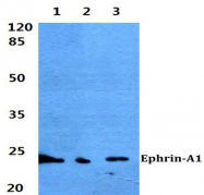 AP20378PU-N - Ephrin-A1