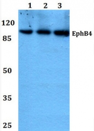 AP20388PU-N - EPHB4
