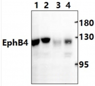 AP20388PU-N - EPHB4