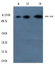 AP20389PU-N - MLLT10 / AF10