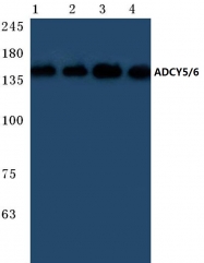 AP20397PU-N - Adenylate cyclase type 5